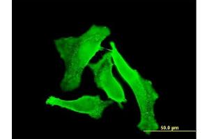 Immunofluorescence of monoclonal antibody to GUCY2D on HeLa cell.