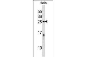 Western blot analysis in Hela cell line lysates (35ug/lane).
