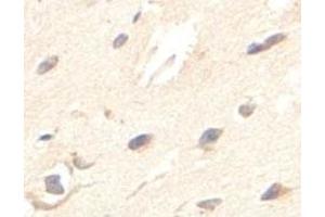 Immunohistochemical analysis of paraffin-embedded human fetal brain showing cytoplasmic staining with ZBED5 polyclonal antibody  at a 1 : 100 dilution. (ZBED5 anticorps  (AA 224-474))