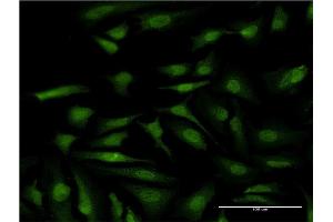 Immunofluorescence of monoclonal antibody to ATP6V1E1 on HeLa cell.