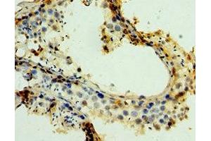 Immunohistochemistry of paraffin-embedded human testis tissue using ABIN7159272 at dilution of 1:100