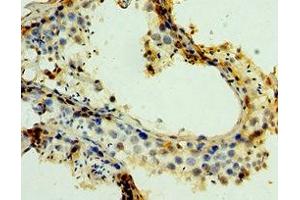 Immunohistochemistry of paraffin-embedded human testis tissue using ABIN7159272 at dilution of 1:100 (MAGEA6 anticorps  (AA 75-314))