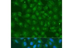 Immunofluorescence analysis of U2OS cells using ZBTB20 Polyclonal Antibody at dilution of 1:100. (ZBTB20 anticorps)