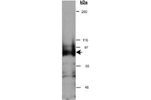 Western blot analysis of CYTSB in HeLa whole cell lysate (RIPA) using CYTSB polyclonal antibody  at 0. (NSP5 anticorps  (AA 1-100))