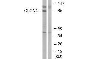 Western blot analysis of extracts from MCF-7 cells, using CLCN4 antibody. (CLCN4 anticorps)