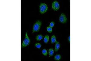 Confocal immunofluorescent analysis of CFH Antibody (Center) with A549 cell followed by Alexa Fluor® 489-conjugated goat anti-rabbit lgG (green). (Complement Factor H anticorps  (Middle Region))