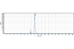 anti-IL6 (Olokizumab Biosimilar) antibody