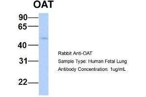 Host:  Rabbit  Target Name:  OAT  Sample Type:  Human Fetal Lung  Antibody Dilution:  1.
