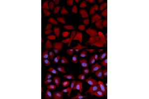 Immunofluorescence analysis of U2OS cells using PSMC4 antibody (ABIN5971339). (PSMC4 anticorps)