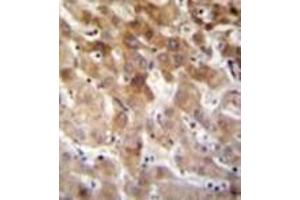Immunohistochemistry analysis in formalin fixed and paraffin embedded human liver tissue reacted with MBTD1 Antibody (C-term) followed which was by peroxidase conjugated to the secondary antibody and followed by DAB staining. (MBTD1 anticorps  (C-Term))
