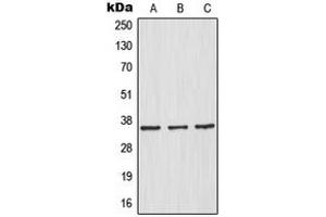 Western blot analysis of IKB alpha expression in HeLa (A), HepG2 (B), Raw264. (NFKBIA anticorps  (N-Term))