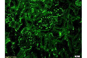 Formalin-fixed and paraffin embedded mouse kidney labeled with Anti-C3 Polyclonal Antibody, Unconjugated (ABIN681913) at 1:200 followed by conjugation to the secondary antibody Goat Anti-Rabbit IgG, FITC conjugated used at 1:200 dilution for 40 minutes at 37°C