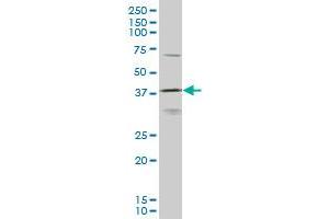 HOXD11 monoclonal antibody (M10), clone 6C8 Western Blot analysis of HOXD11 expression in K-562 . (HOXD11 anticorps  (AA 1-76))