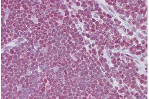 Anti-CD40LG / CD54 antibody IHC staining of human thymus. (CD40 Ligand anticorps  (AA 108-157))