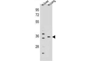 Western blot analysis of KCNRG Antibody (C-term) in mouse liver,lung tissue lysates (35ug/lane). (KCNRG anticorps  (C-Term))