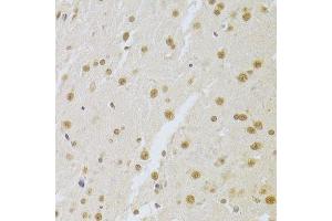 Immunohistochemistry of paraffin-embedded mouse brain using SNRPA Antibody. (SNRPA1 anticorps  (AA 1-282))