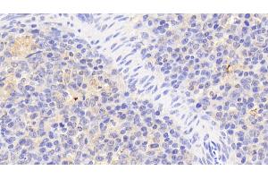 Detection of IkBz in Human Spleen Tissue using Polyclonal Antibody to Inhibitory Subunit Of NF Kappa B Zeta (IkBz)