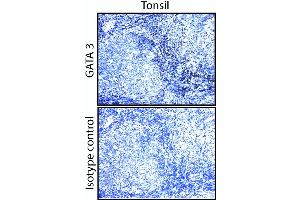 GATA3 staining on human tonsil and breast.