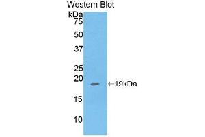 Detection of Recombinant PHLDA2, Mouse using Polyclonal Antibody to Pleckstrin Homology Like Domain Family A, Member 2 (PHLDA2)
