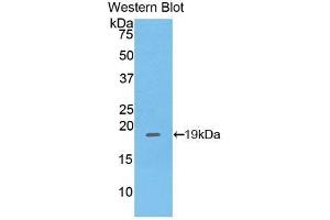Detection of Recombinant PHLDA2, Mouse using Polyclonal Antibody to Pleckstrin Homology Like Domain Family A, Member 2 (PHLDA2) (PHLDA2 anticorps  (AA 9-140))