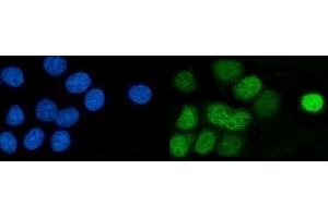 IF analysis of AP2 Gamma/TFAP2C using anti-AP2 Gamma/TFAP2C antibody (ABIN7599099).