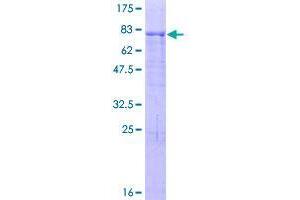 Image no. 1 for Zinc Finger Protein 480 (ZNF480) (AA 1-516) protein (GST tag) (ABIN1326225)
