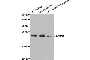 Western blot analysis of extracts of various cell lines, using MSMB antibody. (MSMB anticorps)