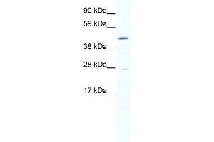 WB Suggested Anti-SMYD1 Antibody Titration:  0. (SMYD1 anticorps  (N-Term))