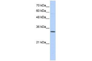 Sideroflexin 1 antibody used at 1 ug/ml to detect target protein. (SFXN1 anticorps  (N-Term))