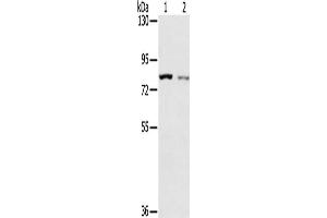 Gel: 6 % SDS-PAGE, Lysate: 40 μg, Lane 1-2: A549 cells, A172 cells, Primary antibody: ABIN7192629(SPATA5L1 Antibody) at dilution 1/200, Secondary antibody: Goat anti rabbit IgG at 1/8000 dilution, Exposure time: 2 minutes (SPATA5L1 anticorps)