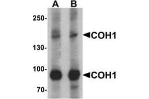 Western blot analysis of COH1 in SK-N-SH cell lysate with COH1 Antibody  antibody at (A) 1 and (B) 2 μg/ml. (VPS13B anticorps  (N-Term))