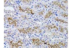 Immunohistochemistry of paraffin-embedded rat kidney using GGT1 antibody (ABIN3022526, ABIN3022527, ABIN3022528 and ABIN6218881) at dilution of 1:100 (40x lens).