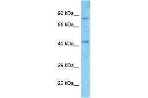 Host:  Rabbit  Target Name:  SIM2  Sample Type:  A549 Whole Cell lysates  Antibody Dilution:  1. (SIM2 anticorps  (Middle Region))