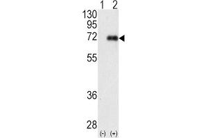Western Blotting (WB) image for anti-Protein Kinase C, iota (PRKCI) antibody (ABIN3002935) (PKC iota anticorps)
