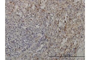 Immunoperoxidase of monoclonal antibody to GRAP2 on formalin-fixed paraffin-embedded human spleen.