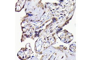 Immunohistochemistry of paraffin-embedded human placenta using GAPDH Rabbit mAb (ABIN7267454) at dilution of 1:100 (40x lens). (GAPDH anticorps)