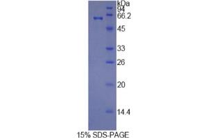 SDS-PAGE analysis of Human HRG Protein. (HRG Protéine)
