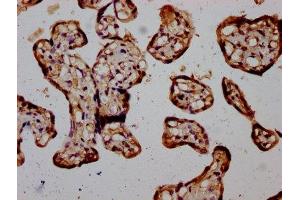 IHC image of ABIN7169168 diluted at 1:400 and staining in paraffin-embedded human placenta tissue performed on a Leica BondTM system. (RIOK2 anticorps  (AA 316-448))