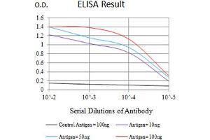 Black line: Control Antigen (100 ng),Purple line: Antigen (10 ng), Blue line: Antigen (50 ng), Red line:Antigen (100 ng)