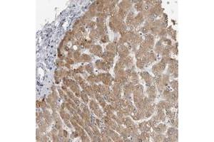 Immunohistochemical staining of human liver with PRSS38 polyclonal antibody  shows cytoplasmic positivity in hepatocytes. (PRSS38 anticorps)