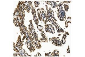 IHC analysis of VAPB using anti-VAPB antibody (ABIN5693292). (VAPB anticorps  (AA 2-55))
