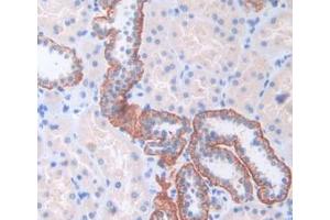 IHC-P analysis of Human Kidney Tissue, with DAB staining. (CENPI anticorps  (AA 292-528))