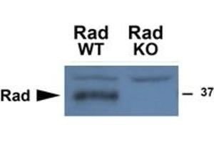 Western Blotting (WB) image for anti-Ras-Related Associated with Diabetes (RRAD) (Internal Region) antibody (ABIN2465070) (RRAD anticorps  (Internal Region))