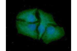 ICC/IF analysis of SMAC in HeLa cells line, stained with DAPI (Blue) for nucleus staining and monoclonal anti-human SMAC antibody (1:100) with goat anti-mouse IgG-Alexa fluor 488 conjugate (Green).