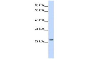 SCAND2 antibody used at 0. (SCAND2 anticorps  (Middle Region))