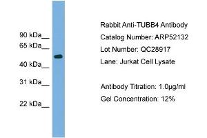 WB Suggested Anti-TUBB4  Antibody Titration: 0. (TUBB4 anticorps  (N-Term))