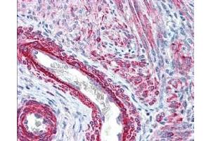 affinity purified anti-Monophosphorylated RLC Smooth and Non-Muscle Myosin pS19/20 antibody was used at 2.