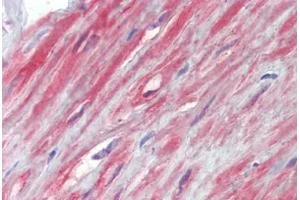 Prostate, fibromuscular stroma, Human: Formalin-Fixed, Paraffin-Embedded (FFPE) (TRPC1 anticorps  (AA 722-733))