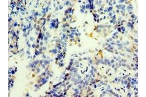 Immunohistochemistry of paraffin-embedded human lung tissue using ABIN7173394 at dilution of 1:100 (TGS1 anticorps  (AA 714-853))