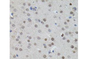 Immunohistochemistry of paraffin-embedded Mouse brain using MYCN Polyclonal Antibody